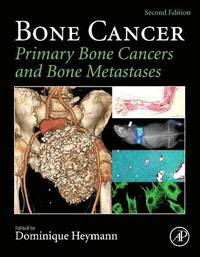 Bone Cancer (hftad)