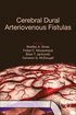 Cerebral Dural Arteriovenous Fistulas