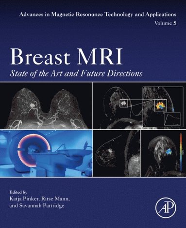 Breast MRI (häftad)