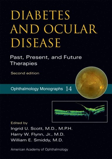 Diabetes and Ocular Disease (e-bok)