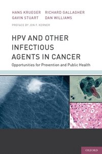 HPV and Other Infectious Agents in Cancer (e-bok)