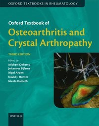 Oxford Textbook of Osteoarthritis and Crystal Arthropathy (e-bok)