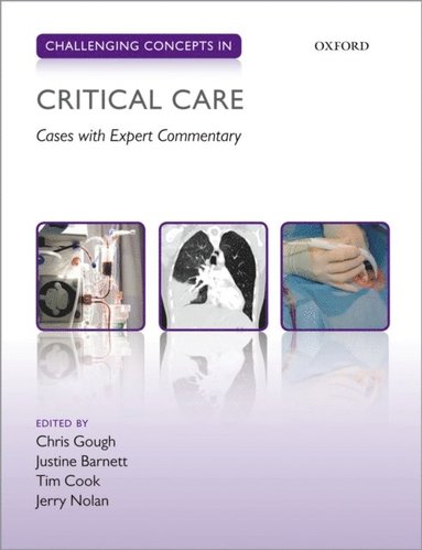 Challenging Concepts in Critical Care (e-bok)