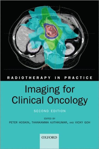 Imaging for Clinical Oncology (e-bok)