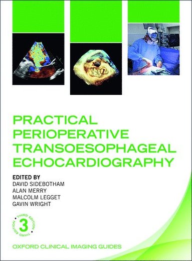 Practical Perioperative Transoesophageal Echocardiography (häftad)