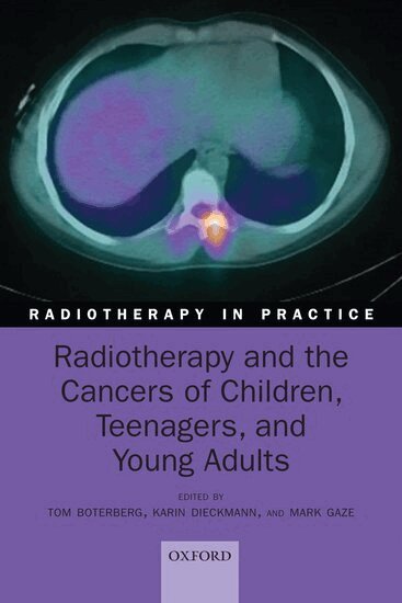 Radiotherapy and the Cancers of Children, Teenagers, and Young Adults (kartonnage)