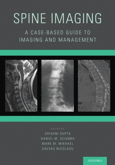Spine Imaging (e-bok)