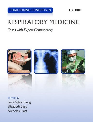 Challenging Concepts in Respiratory Medicine (h�ftad)