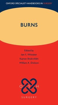 Burns Iain S Whitaker Häftad 9780199699537 Bokus - 