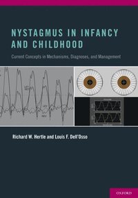 Nystagmus In Infancy and Childhood (inbunden)