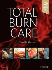 Total Burn Care (inbunden)