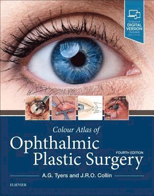Colour Atlas of Ophthalmic Plastic Surgery (inbunden)