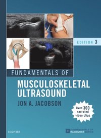 Fundamentals of Musculoskeletal Ultrasound E-Book (e-bok)
