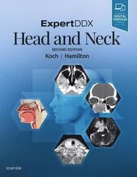 ExpertDDX: Head and Neck (inbunden)