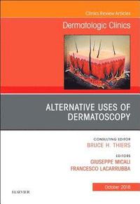 Alternative Uses of Dermatoscopy, An Issue of Dermatologic Clinics (inbunden)