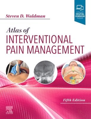 Atlas of Interventional Pain Management (inbunden)