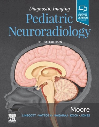 Diagnostic Imaging: Pediatric Neuroradiology E-Book (hftad)