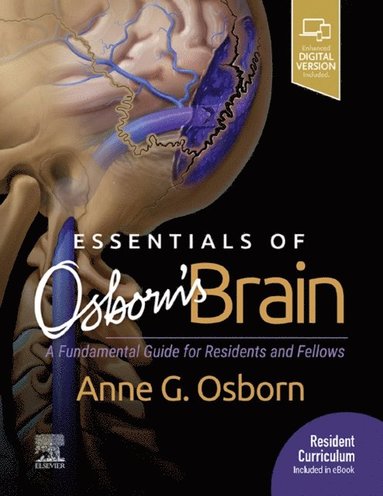 Essentials of Osborn's Brain E-Book (h�ftad)
