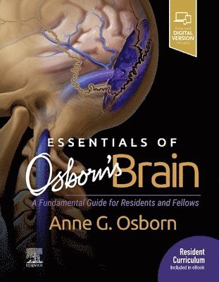 Essentials of Osborn's Brain (h�ftad)