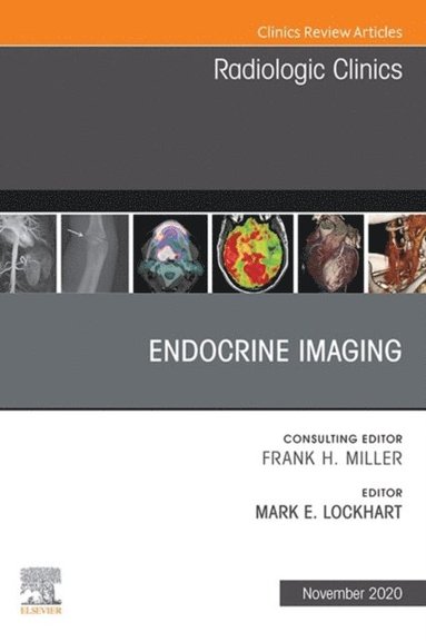 Endocrine Imaging, An Issue of Radiologic Clinics of North America, E-Book (hftad)