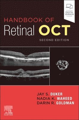 Handbook of Retinal OCT: Optical Coherence Tomography (häftad)