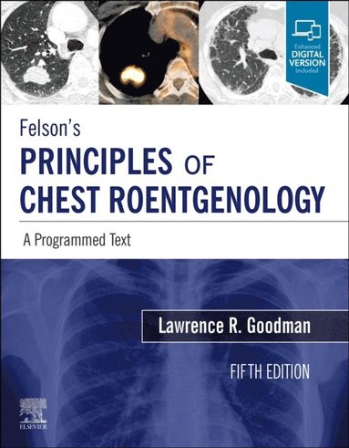 Felson's Principles of Chest Roentgenology E-Book (häftad)