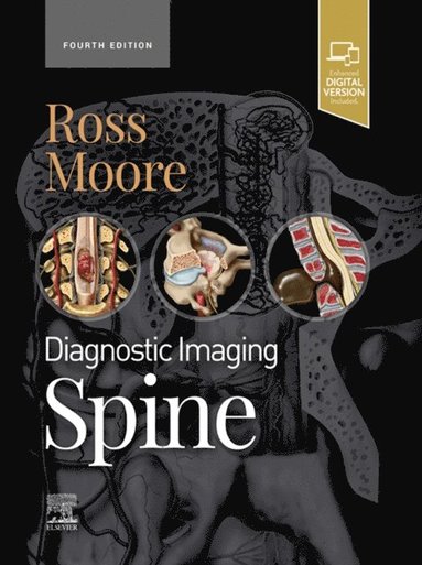 Diagnostic Imaging: Spine - E-Book (h�ftad)