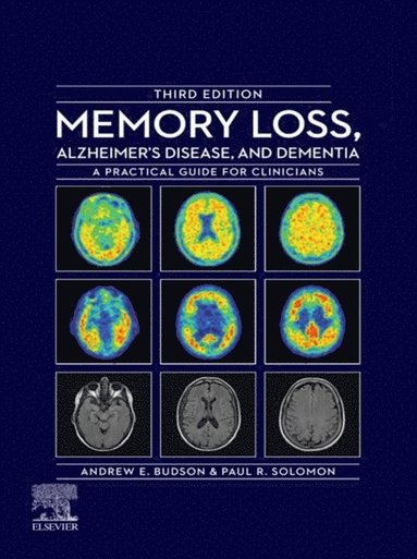 Memory Loss, Alzheimer's Disease, and Dementia - E-Book (inbunden)