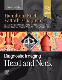 Diagnostic Imaging: Head and Neck (inbunden)