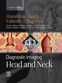 Diagnostic Imaging: Head and Neck - E-Book (e-bok)