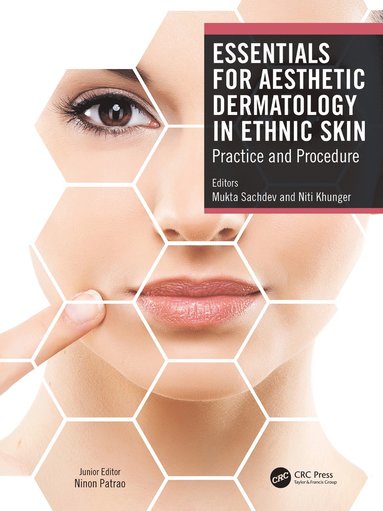 Essentials for Aesthetic Dermatology in Ethnic Skin (inbunden)