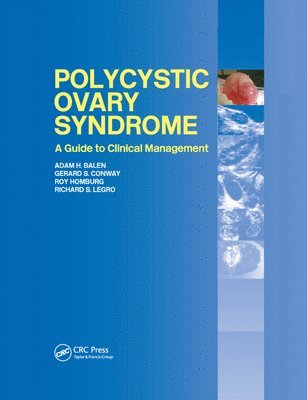 Polycystic Ovary Syndrome (inbunden)