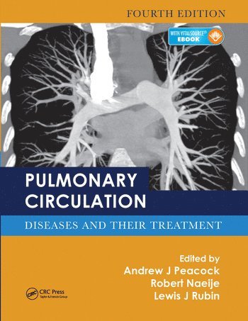 Pulmonary Circulation (hftad)