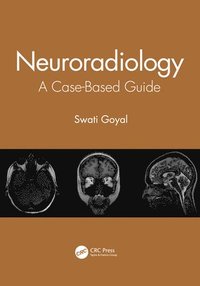 Neuroradiology (hftad)