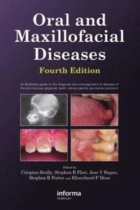 Oral and Maxillofacial Diseases, Fourth Edition (inbunden)