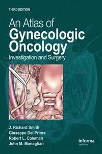 An Atlas of Gynecologic Oncology (inbunden)
