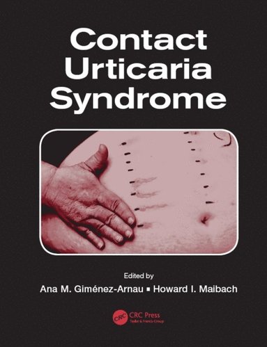 Contact Urticaria Syndrome (e-bok)