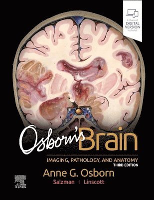 Osborn's Brain (h�ftad)