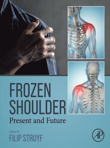 Frozen Shoulder (inbunden)