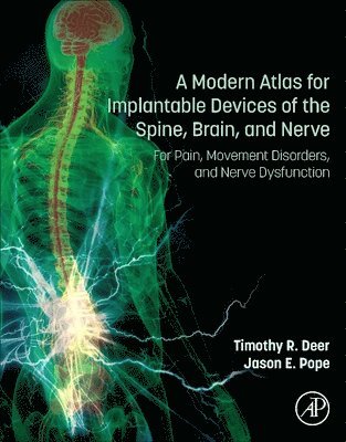 Modern Atlas for Implantable Devices of the Spine, Brain, and Nerve (inbunden)