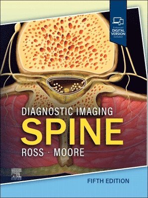 Diagnostic Imaging: Spine (häftad)