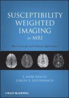 MRI Susceptibility Weighted Imaging: Basic Concepts and Clinical ...