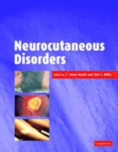 Neurocutaneous Disorders (e-bok)