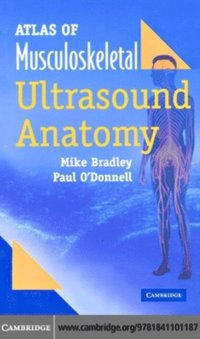 Atlas of Musculoskeletal Ultrasound Anatomy (e-bok)