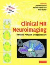 Clinical MR Neuroimaging (e-bok)