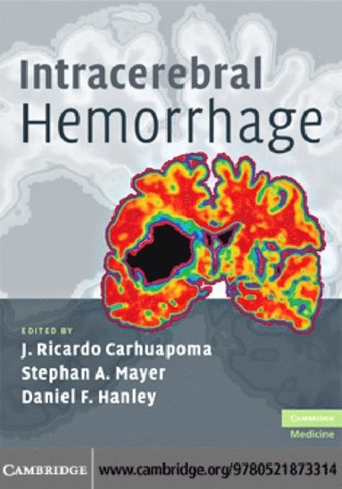 Intracerebral Hemorrhage (e-bok)