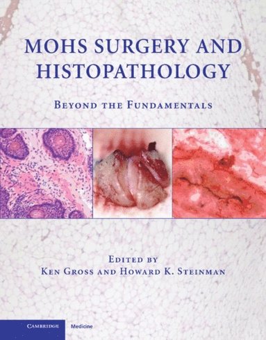 Mohs Surgery and Histopathology (inbunden)
