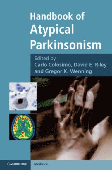 Handbook of Atypical Parkinsonism (e-bok)