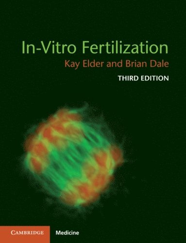 In-Vitro Fertilization (e-bok)