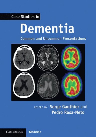 Case Studies in Dementia: Volume 1 (hftad)